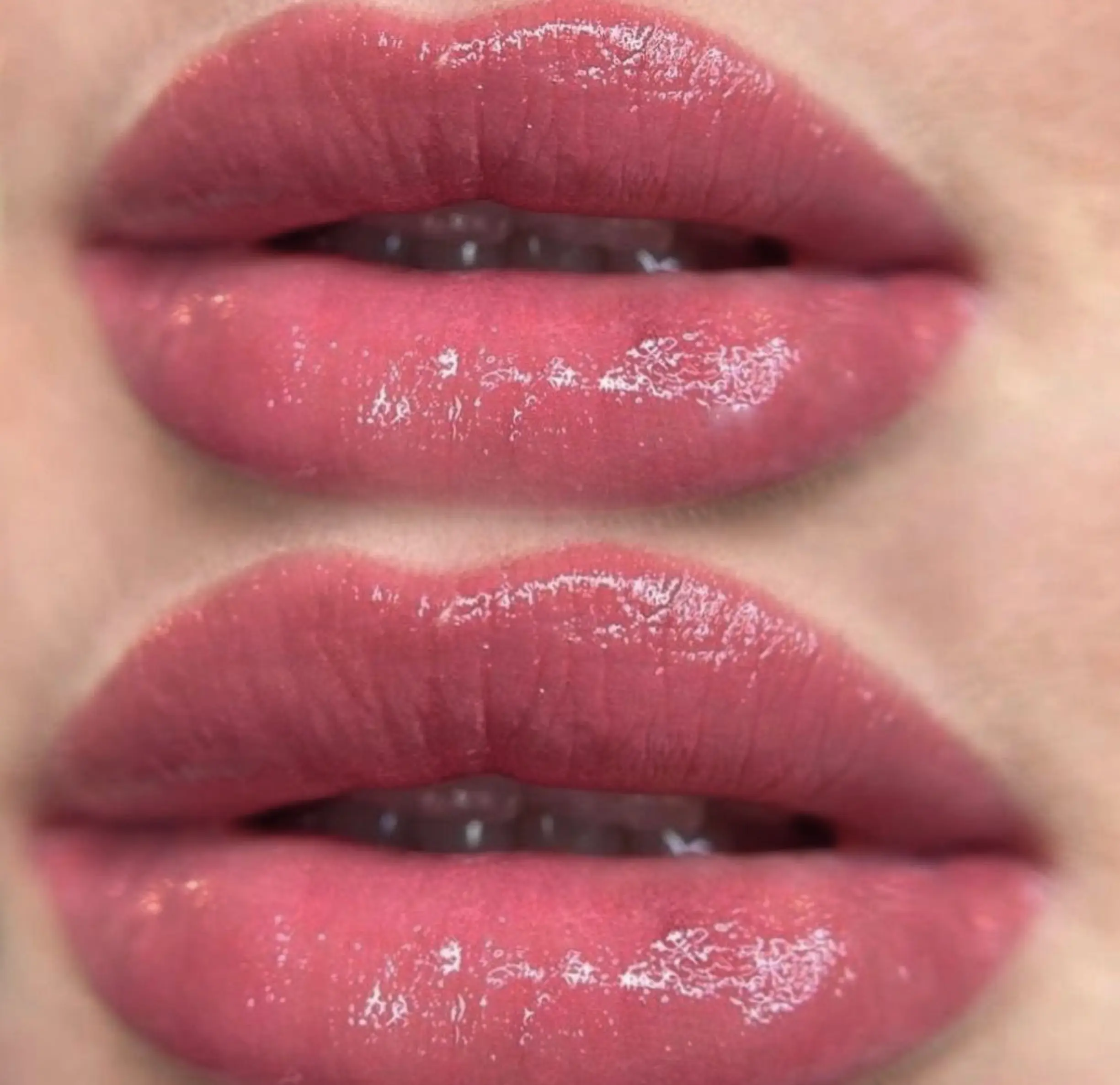 lip tattoo vs lip fillers