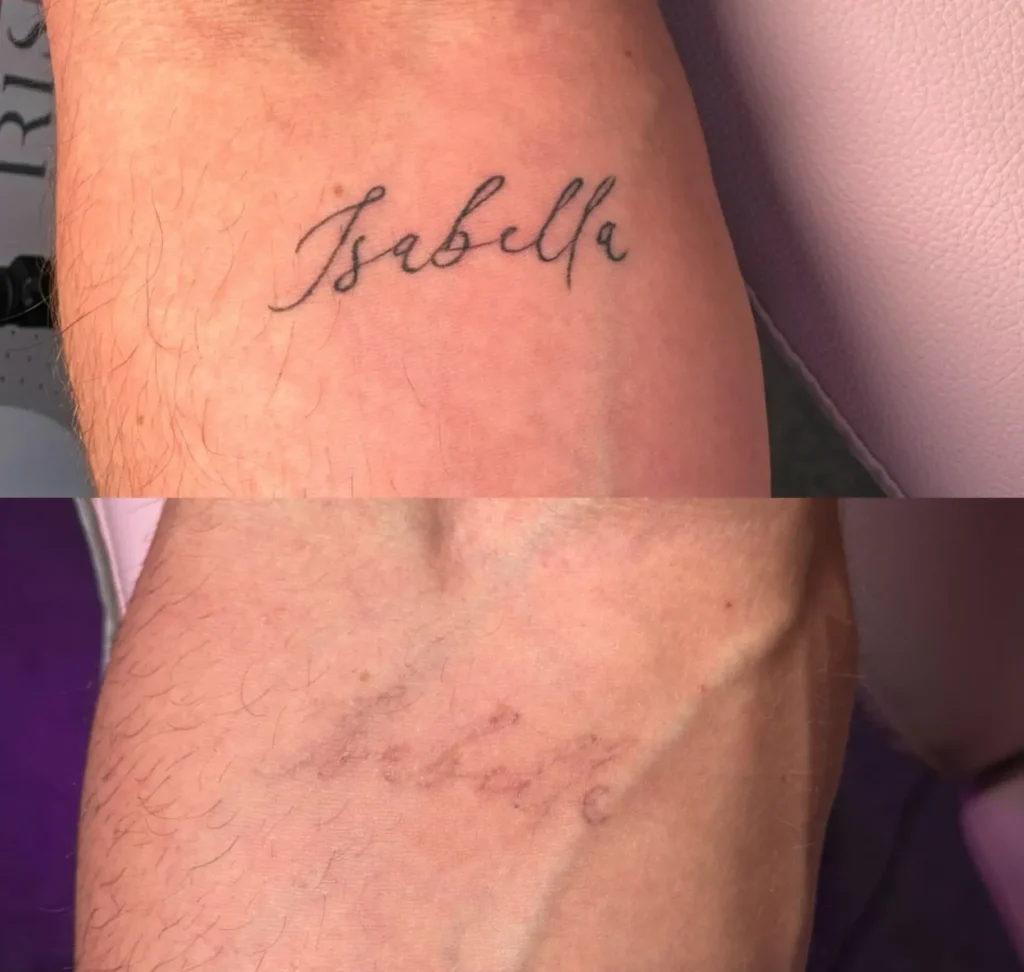 Why Tattoo Skills Are in High Demand